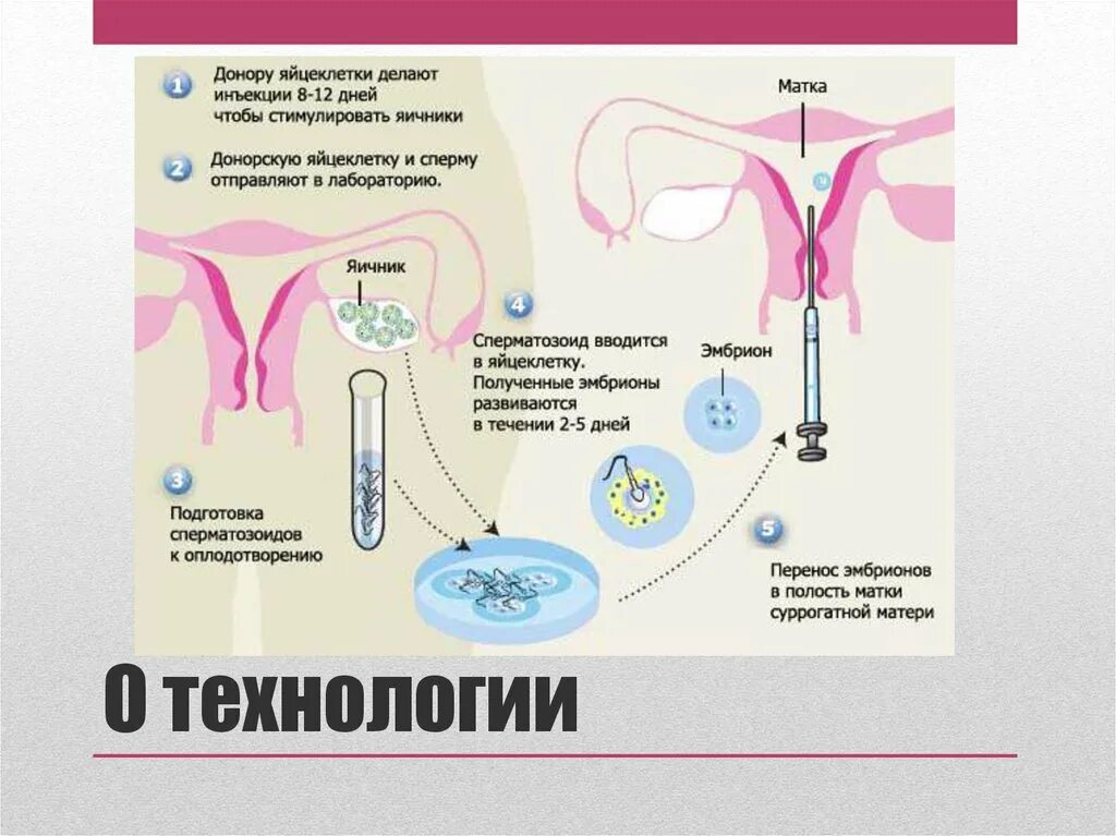 Донорство яйцеклеток. Перенос эмбрионов в полость матки. Донорство сперматозоидов и яйцеклеток. Яйцеклетка женщины. Бесплодие донор