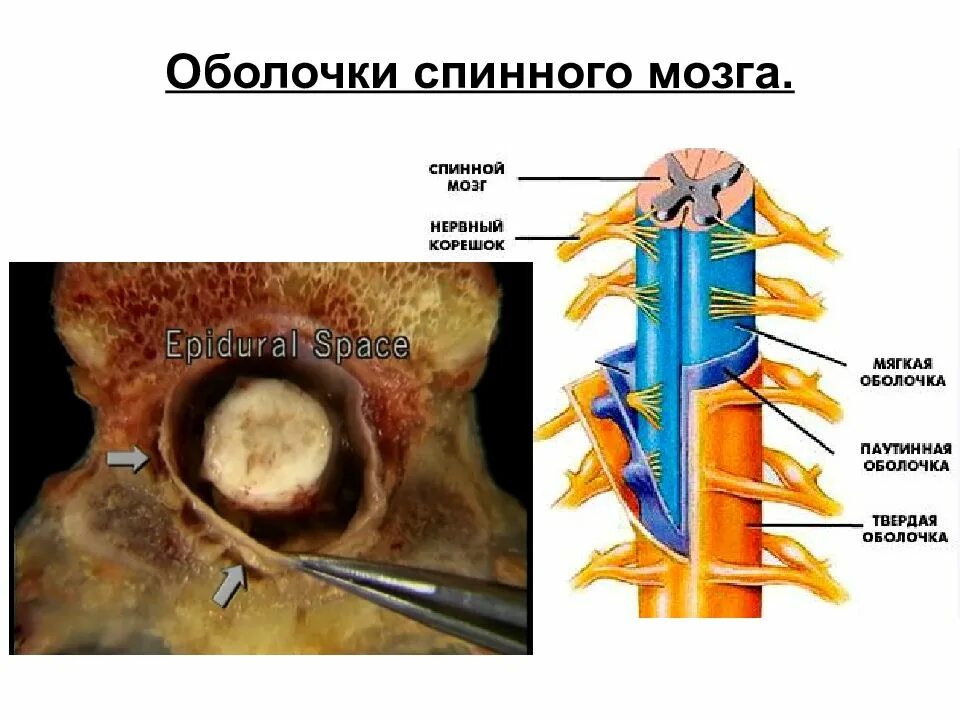 Жидкость в спинном канале. Оболочки спинного мозга ликвор. Паутинная оболочка спинного мозга. Паутинная оболочка спинного мозга на препарате. Твердая мозговая оболочка спинного мозга анатомия.