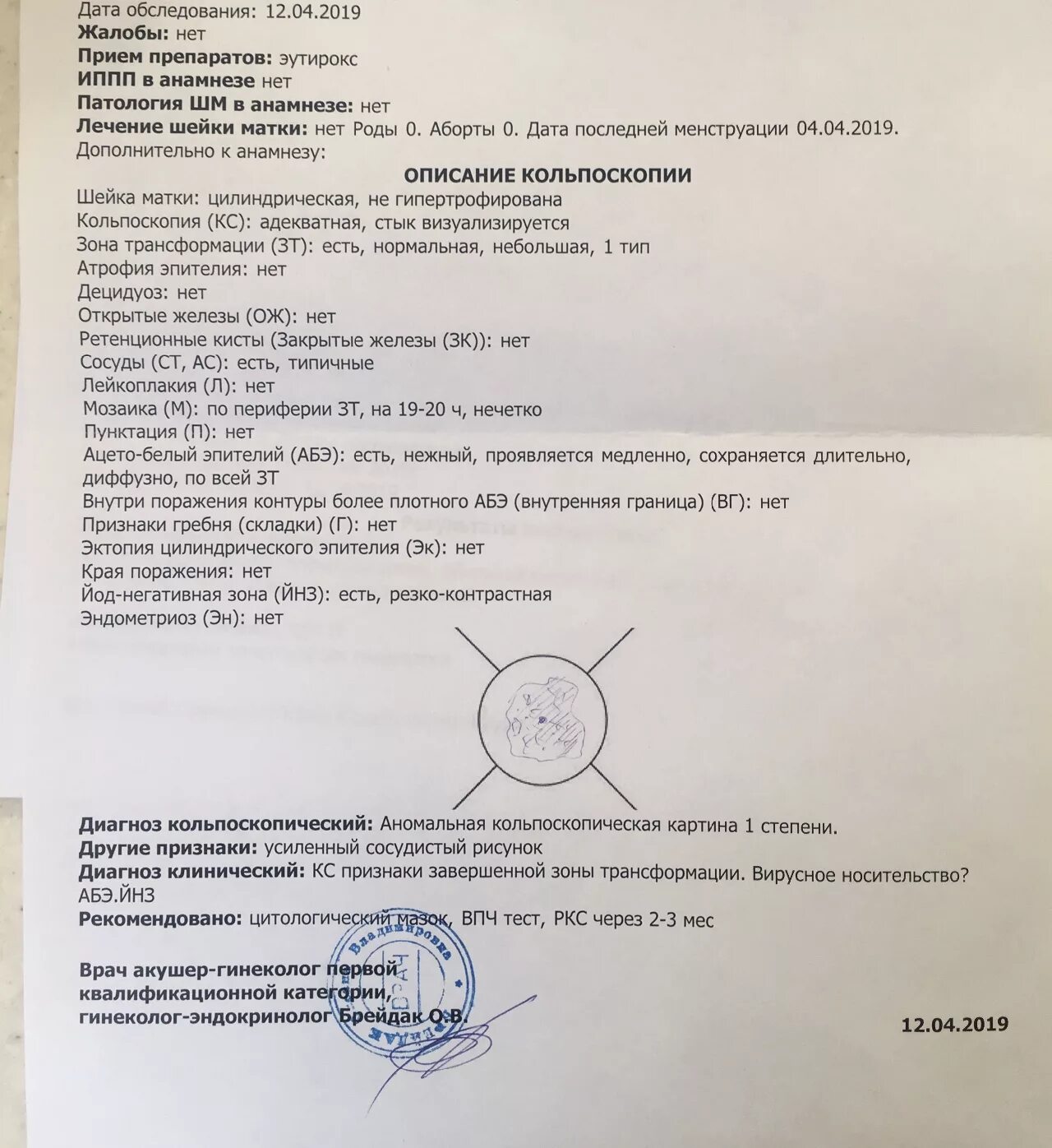 Результаты кольпоскопии сколько. Расшифровка протокола кольпоскопии шейки матки. ацетобелый эпителий дисплазия.