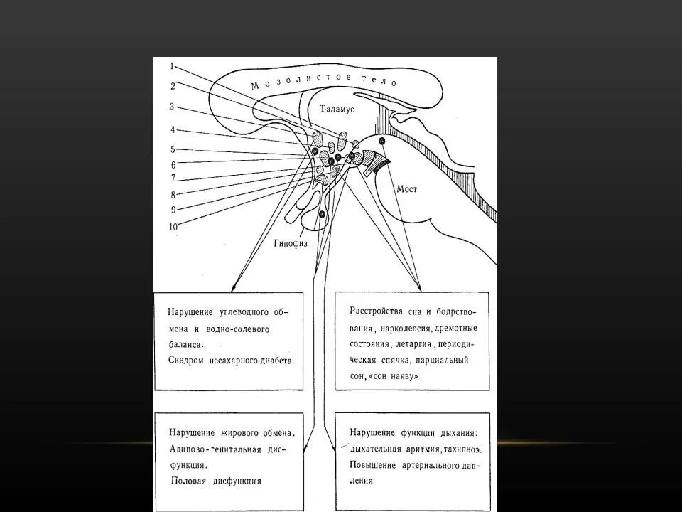 Функции таламуса промежуточного мозга. 21. Симптомы и синдромы поражения гипоталамической области. Нарушение функций таламуса и гипоталамуса. Поражение гипоталамуса неврология. Симптомы повреждения гипоталамуса физиология.