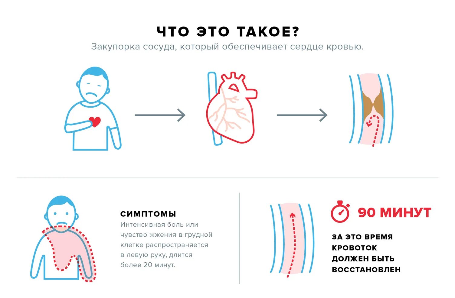 Синдром острой коронарной недостаточности симптомы. Острый коронарный синдром симптомы. Симптомы остром коронарном синдроме. Острого коронарного синдрома (Окс) неотложная помощь.