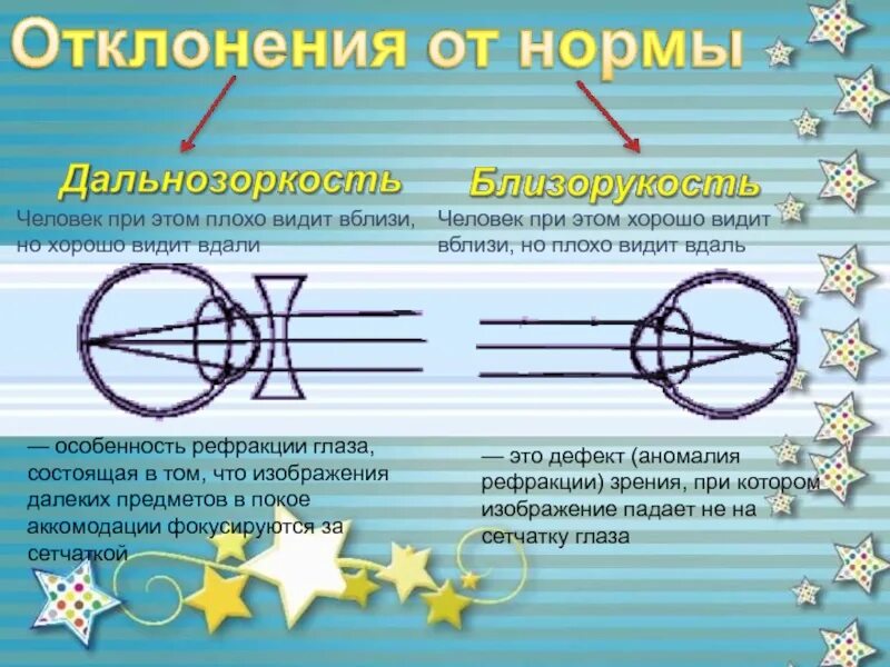 Плохо вижу вдали как называется. Вижу плохо вдаль и вблизи это. Когда человек плохо видит вблизи как называется. Человек плохо видит вблизи и вдаль. Близко видеть далеко плохо