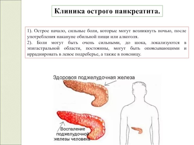 Локализация панкреатита. Острый панкреатит боль. Острый панкреатит определение. Острый панкреатит клиника.