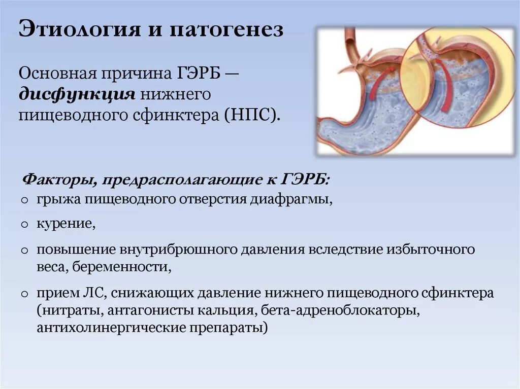 Гастроэзофагеальный рефлюкс описание. Гастроэзофагеальная рефлюксная болезнь патогенез. Гастроэзофагально-рефлюксная болезнь патогенез. Гастроэзофагеальный рефлюкс этиопатогенез. Гастроэзофагеальная болезнь этиология.