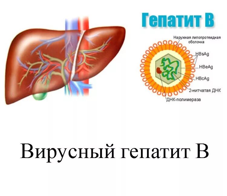 Вирусный гепатит б. Гепатит б 2024