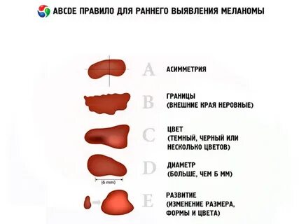 Родинка какие анализы сдавать