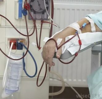 Диализ раз в неделю