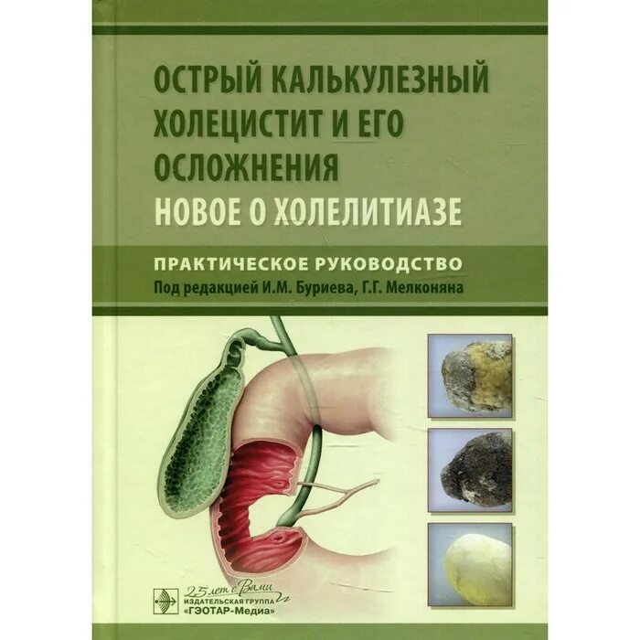 Что такое калькулезный холецистит как лечить. Что такое калькулезный холецистит как лечить