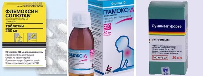 Ребенку 1 от горла что можно дать. При ангине лекарства. лекарства при ангине у детей. препараты для горла при ангине. препараты от ангины для детей.