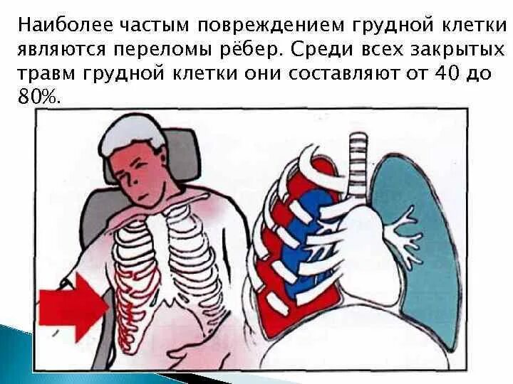 Что надо делать если сломал