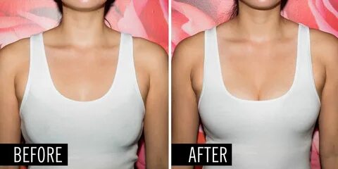 bombshell bra before after.