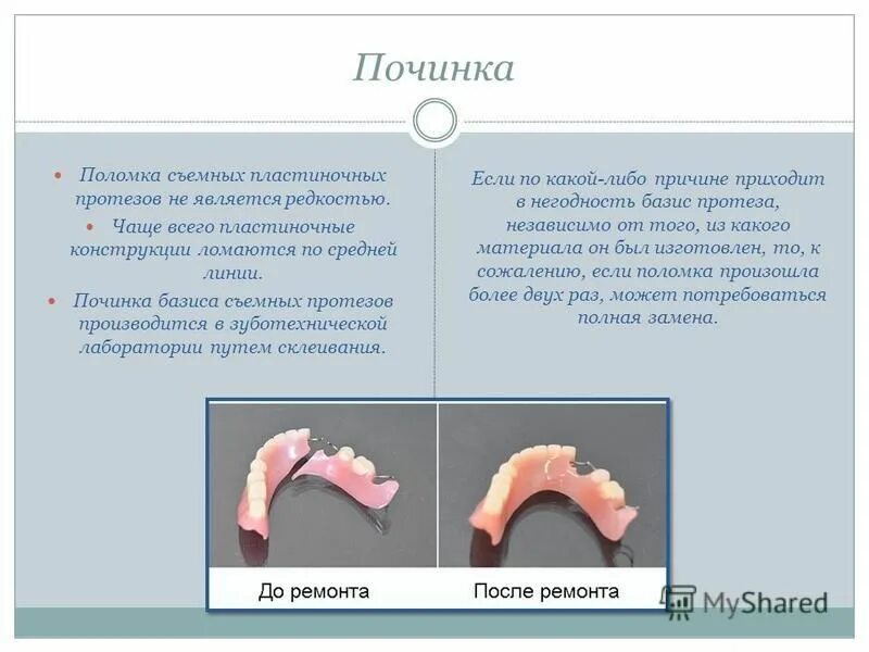 Границы пластиночного протеза. Починка линейного перелома базиса съемного пластиночного протеза. Методы Починок пластиночных протезов. Методы Починки съемных протезов.