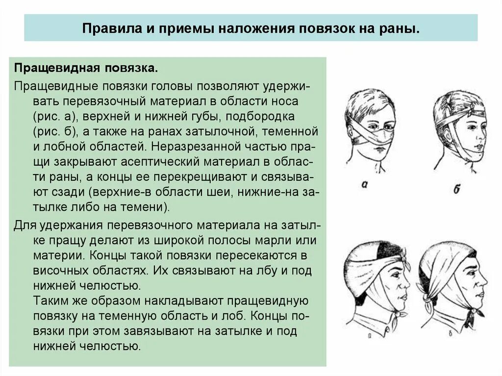 Десмургия пращевидная повязка. Схема наложения повязок Сестринское дело. Наложение пращевидной повязки. Наложение первичной повязки на голову.