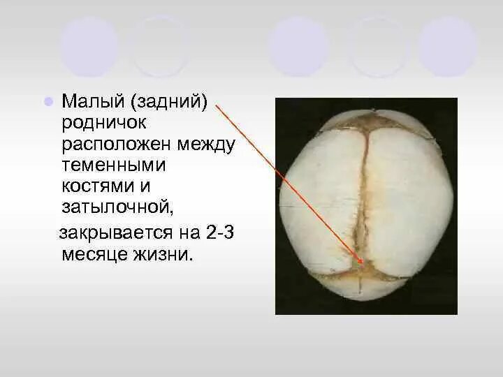 Большой родничок кости. Малый Родничок расположен между костями:. Большой Родничок располагается между костями черепа. Большой Родничок располагается между костями.