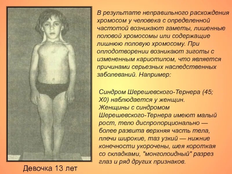 У кого 48 хромосом. Что если у человека меньше хромосом. хромосомы человека.