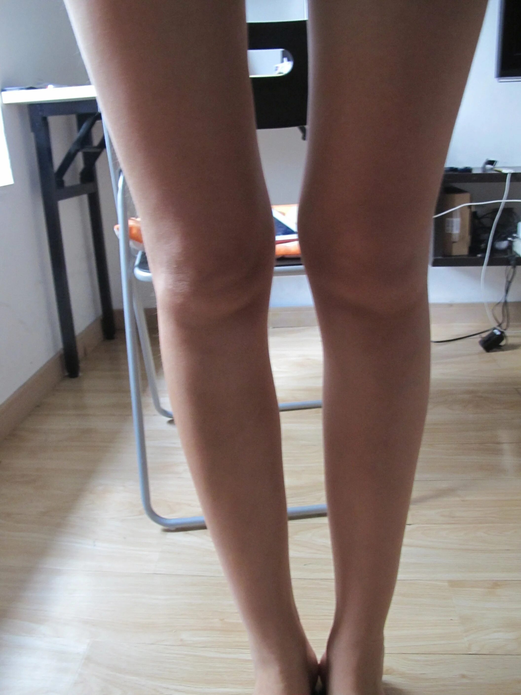 Ноги женщин выше колен. Красивые женские коленки. Худые ноги. Тонкие голени. Красивые колени.