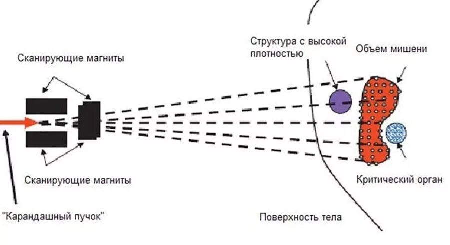 Сканирующий метод. Протонный пучок. метод карандашного пучка. облучение протонным пучком. протонный излучатель.