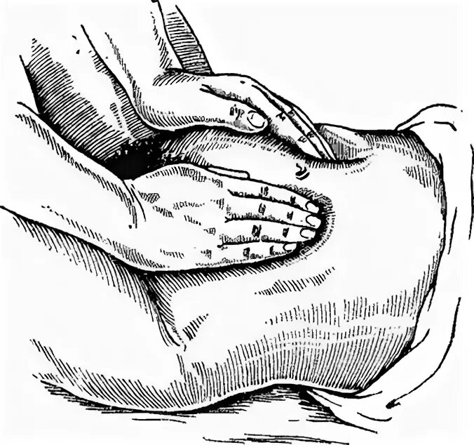 массаж живота. гинекологическая пальпация. пальпация живота гинекология. гинекологическая пальпация. аускультация живота алгоритм.