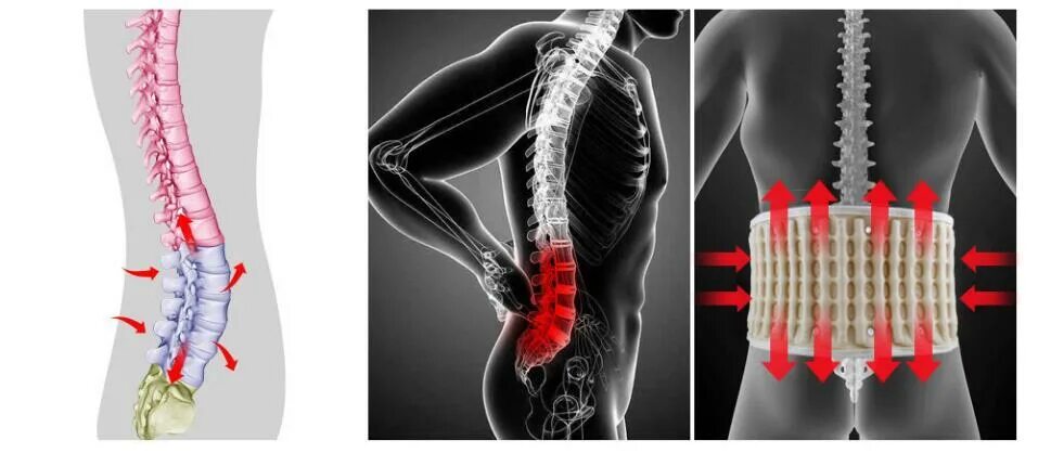 Lumbar Spine dorsopathy. Формирователь поясничного отдела. ТСЛ поясничный. Шарик внутри позвоночника поясничный отдел. Движения поясничного отдела позвоночника