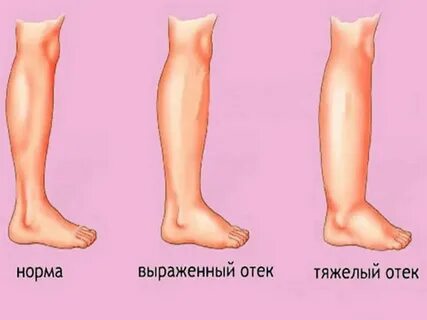 Причины припухнуть