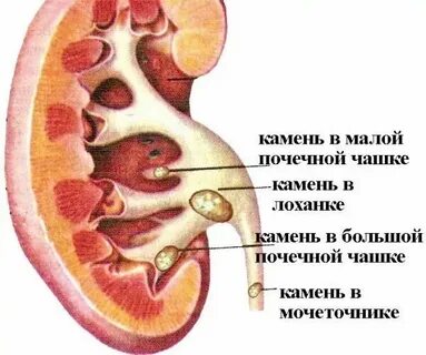 Система конкремента