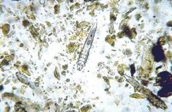 Клещ демодекс микроскопия. Демодекоз под микроскопом. Яйца демодекоза под микроскопом. Демодекоз у собак микроскопия.