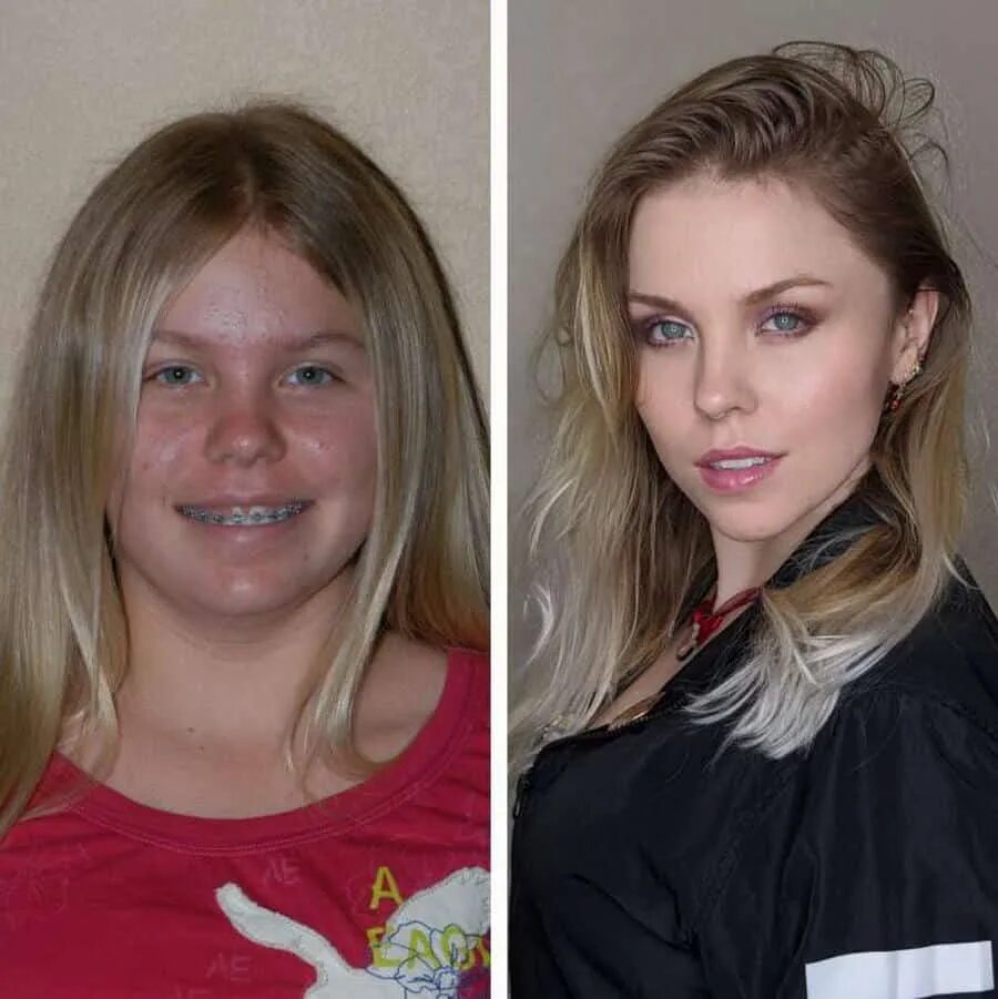 Она изменилась сильно. Изменения девушек до и после. Изменение внешности до и после. Изменение внешности с возрастом девушки. Подростковый Возраст внешность.
