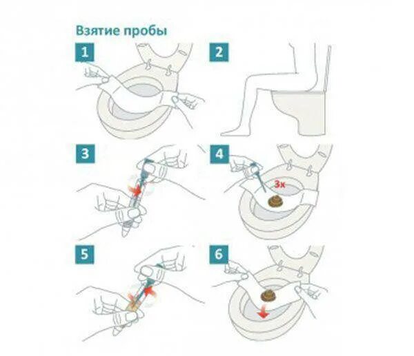 Как собирать анализ кала в баночку. Анализ кала как правильно собрать. Как собрать калл для анализа. Как правильно сдать анализ кала. Как собрать кал для анализа у взрослого.