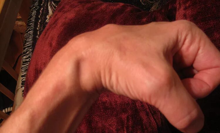 Наросты на костях фото Pin van Makenzie Wittrock op Anatomy