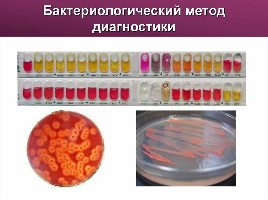 Этапы бактериологического метода диагностики микробиология. Культуральный бактериологический метод исследования. Бактериологический метод исследования 1 этап. Бактериологический метод исследования инфекционных заболеваний. 2 этап бактериологического метода