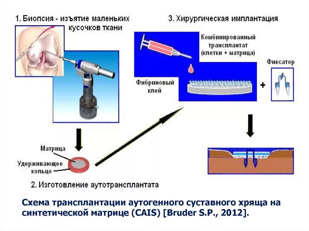 Хирургическая биопсия.