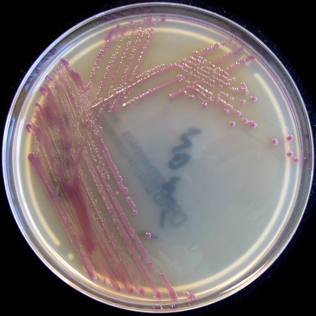 Coli sotwe. Эшерихии кишечная палочка. Escherichia coli под микроскопом. Кишечная палочка Escherichia coli. Палочка эшерихия коли.