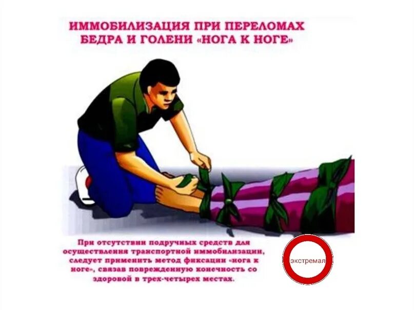 Открытый перелом алгоритм первой помощи. Оказание помощи при переломах. оказание первой помощи пострадавшему. оказание первой помощи при переломах. иммобилизация пострадавшего.