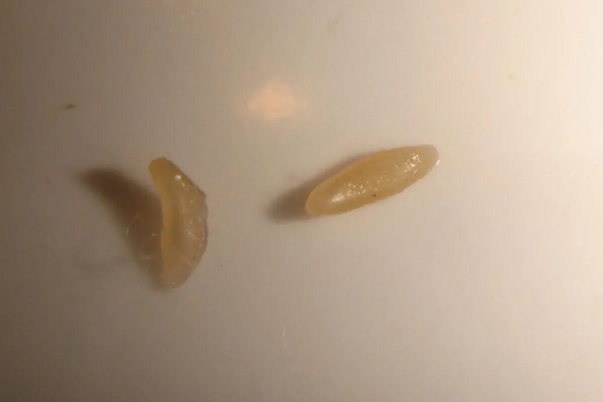 яйца гельминтов огуречного цепня. яйца и личинки гельминтов в кале. как выглядят личинки в кале. фасциолы гепатика. маленькие белые червячки глисты.