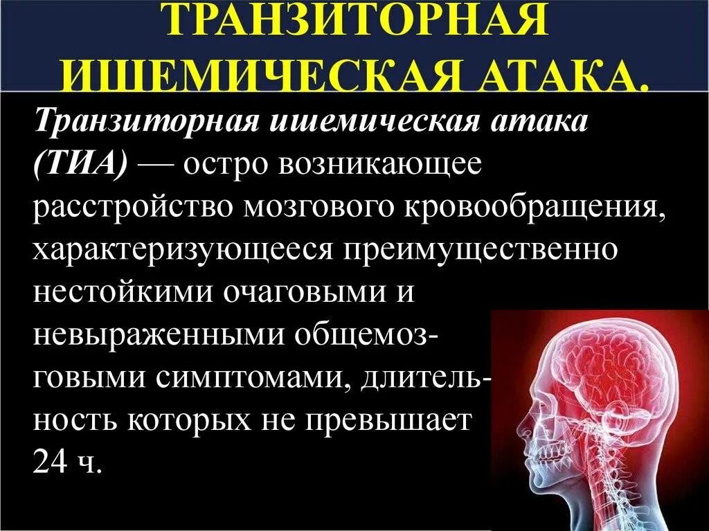 Болезнь ишемия мозга. ОНМК транзиторная ишемическая атака. Транзиторная ишемическая атака головного мозга симптомы. Транзиторно эшемическая атаку. Тразинтлрно игемическая Птака.