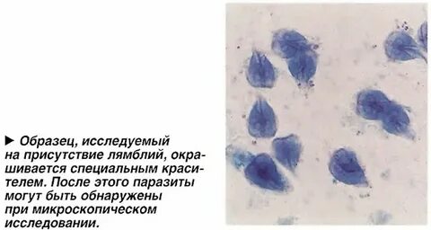Лямблии глаза