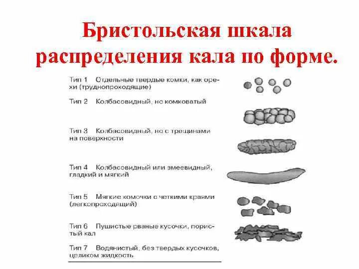 Шкала кала по бристольской шкале. Бристольская шкала кала 6 Тип. Бристольской шкале формы кала. Стул Тип 6 по Бристольской шкале. 5 Тип кала по Бристольской шкале.