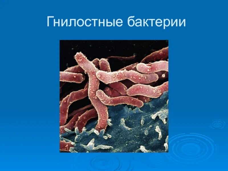 Гнилостные бактерии 5 класс биология. Бактерии гниения. Разлагающие бактерии. К гнилостным бактериям относятся