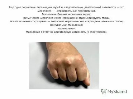 Непроизвольные подергивания