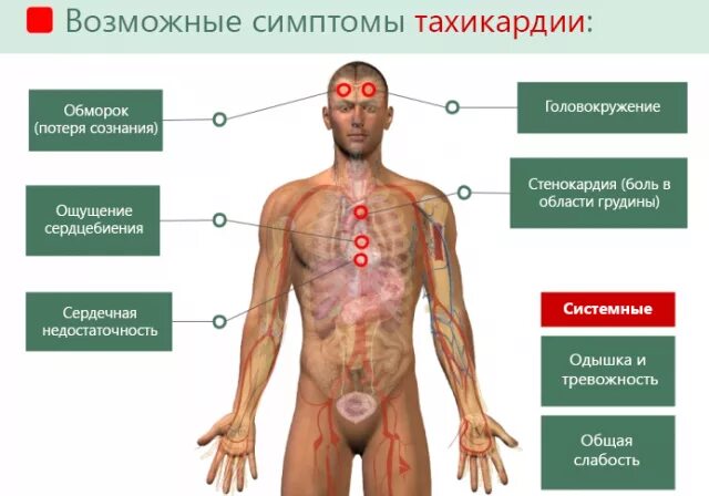 Сильное сердцебиение и боль