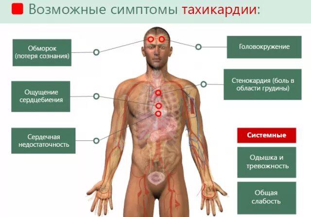 Сон сильное сердцебиение. Симптомы учащенного сердцебиения. Тахикардия симптомы у мужчин. Симптомы тахикардии сердца у мужчин. Симптомы учащенного сердцебиения у мужчин.