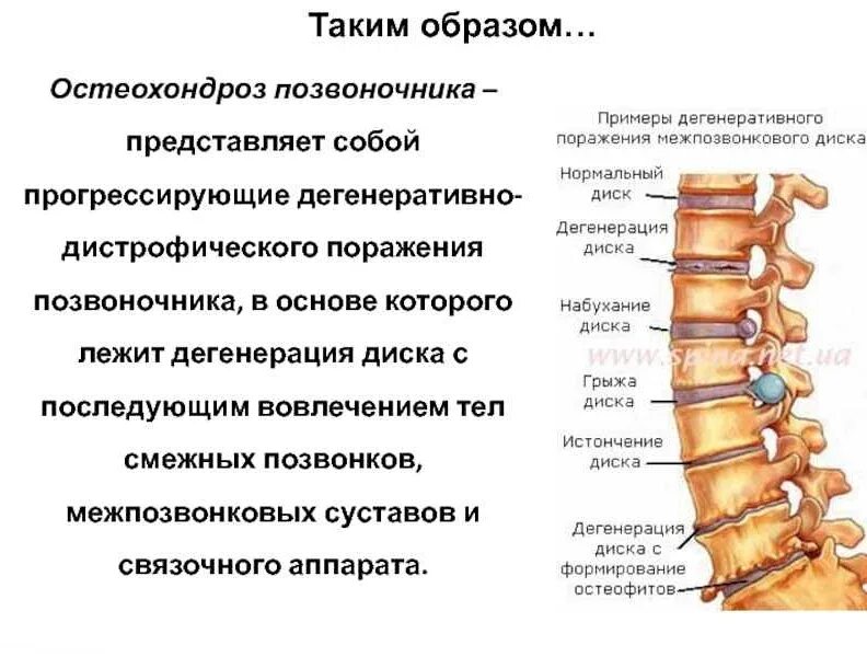 Классификация остеохондроза поясничного отдела позвоночника. Скандроз позвоночника. Остеохондроз поясничного отдела позвоночника симптомы. Лекарства при остеохондрозе поясничного отдела таблетки. Поясничный остеохондроз позвоночнике лечения.