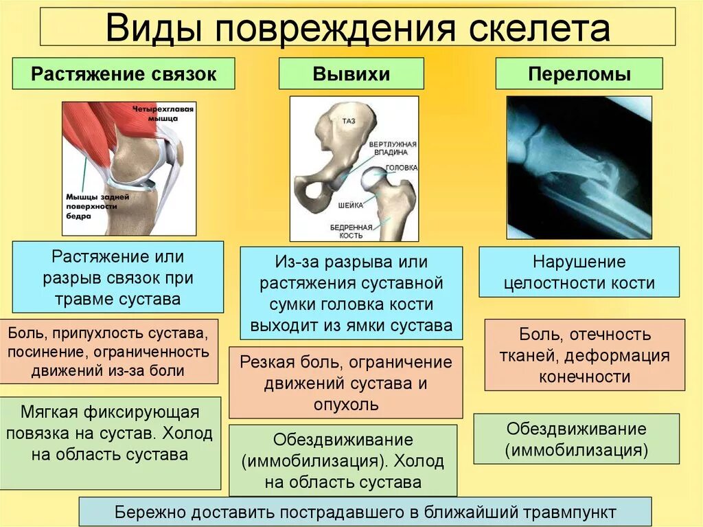 Ушиб растяжение перелом таблица. Виды повреждения скелета таблица. Вид повреждения вывих первая помощь признаки повреждения. Таблица ушибы переломы вывихи. Взять разрыв