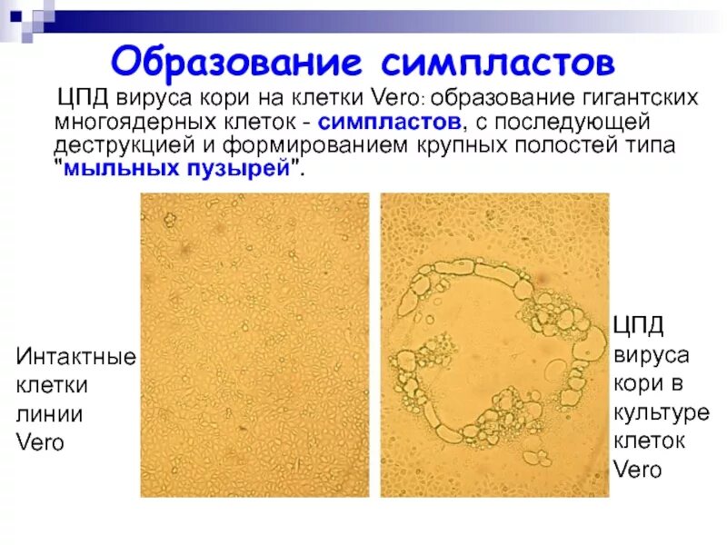 Цпд в культуре клеток энтеровирусов. Цпд вируса это. Цпд вирусов микробиология. Особенности цитопатического действия вирусов. Определение титра вируса.