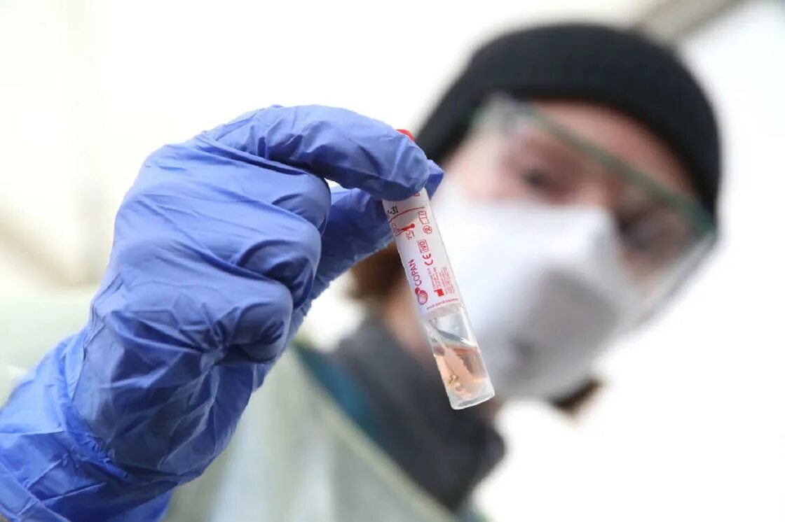 Новости медицины. Sars-cov-2 дельта штамм. Есть случаи коронавируса. Дельта штамм коронавируса. Эпидемиологической.