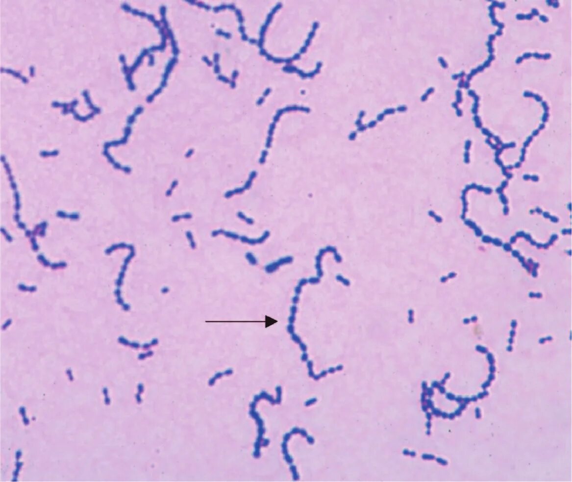 Mobiluncus spp corynebacterium в мазке