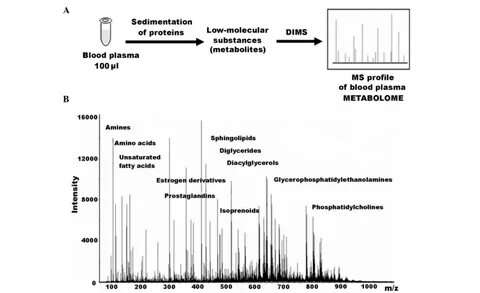 Mass spectrum of elementary particles