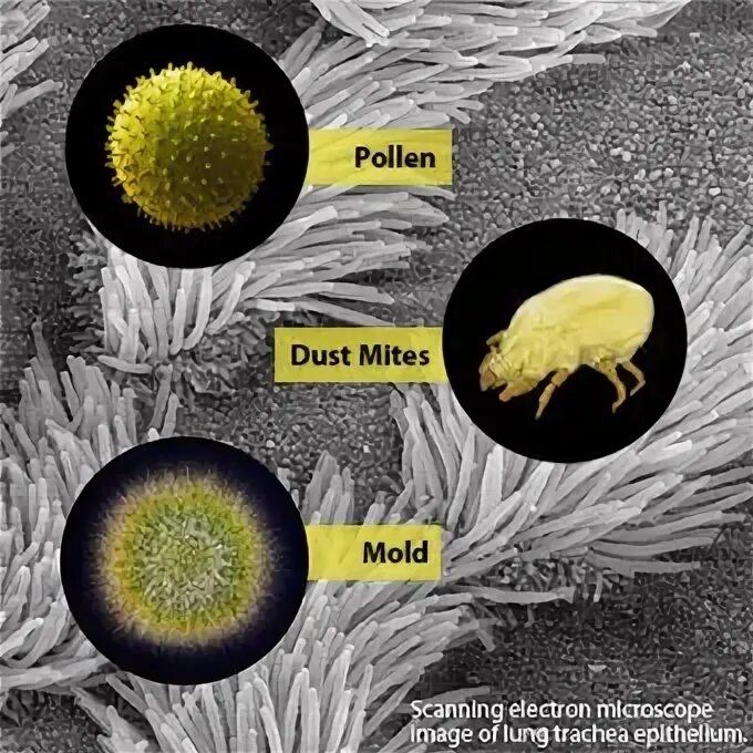 Pollen Allergy treatment. IAQ Dust Mite check. Пыль пыльца