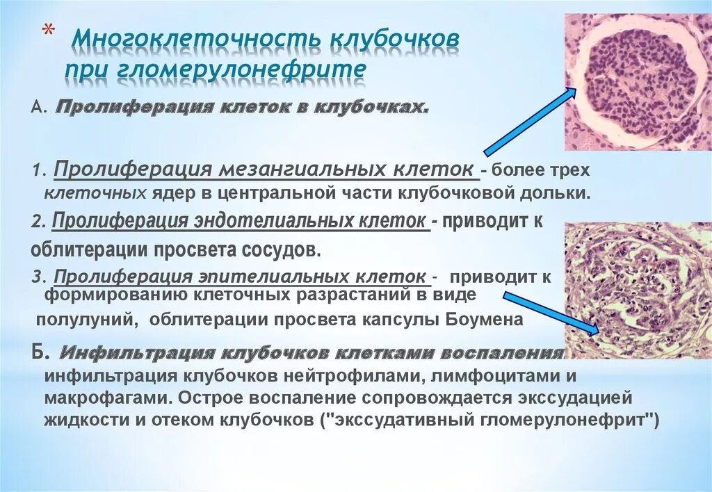 Пролиферация это простыми словами. Пролиферация эндотелиальных клеток при гломерулонефрите. Пролиферация эндотелия сосудов гистология. Пролиферация мезангиальных клеток. Пролиферация мезангиоцитов.