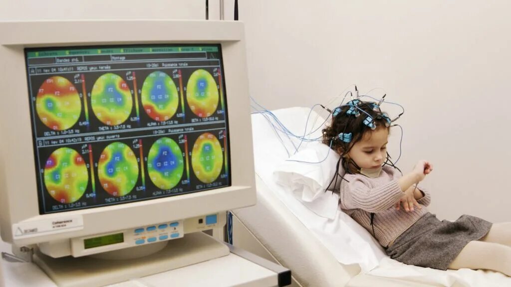 Ээг ребенку платно. ЭЭГ РЭГ Эхо мозга головы. Эхо ЭГ электроэнцефалография. Эхоэнцефалография (Эхо ЭГ) головного мозга. ЭЭГ И Эхо ЭГ что это.